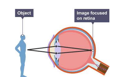 The lens changes shape to focus on near and distant objects