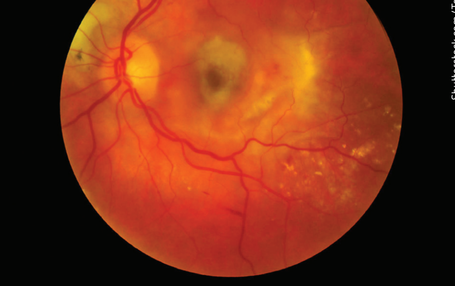 Cross-section imagery via OCT, illustrating detailed images of the retina and optic nerve.
