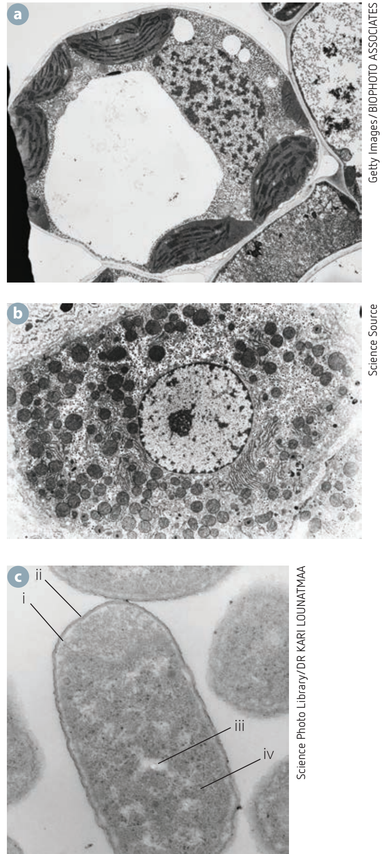 Visual chart of plant cell sizes, highlighting sizes with and without vacuoles.