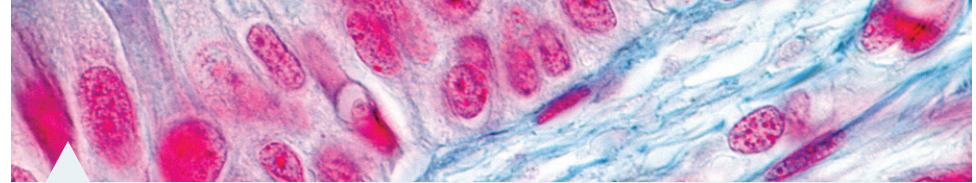 Illustration of MRI and Micro-CT imaging principles and sample images showing plant tissue structure.