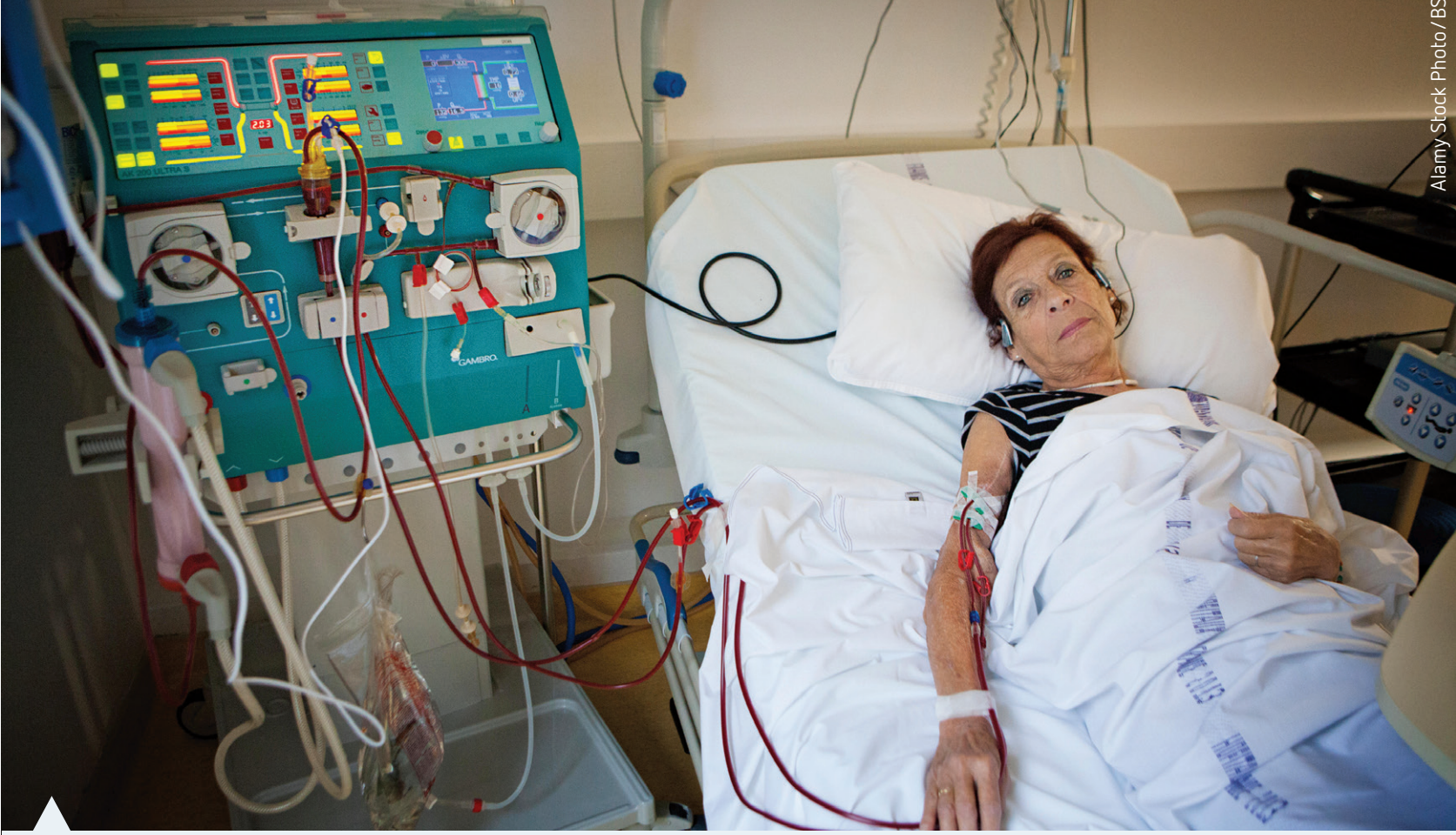 Lifestyle impact of dialysis