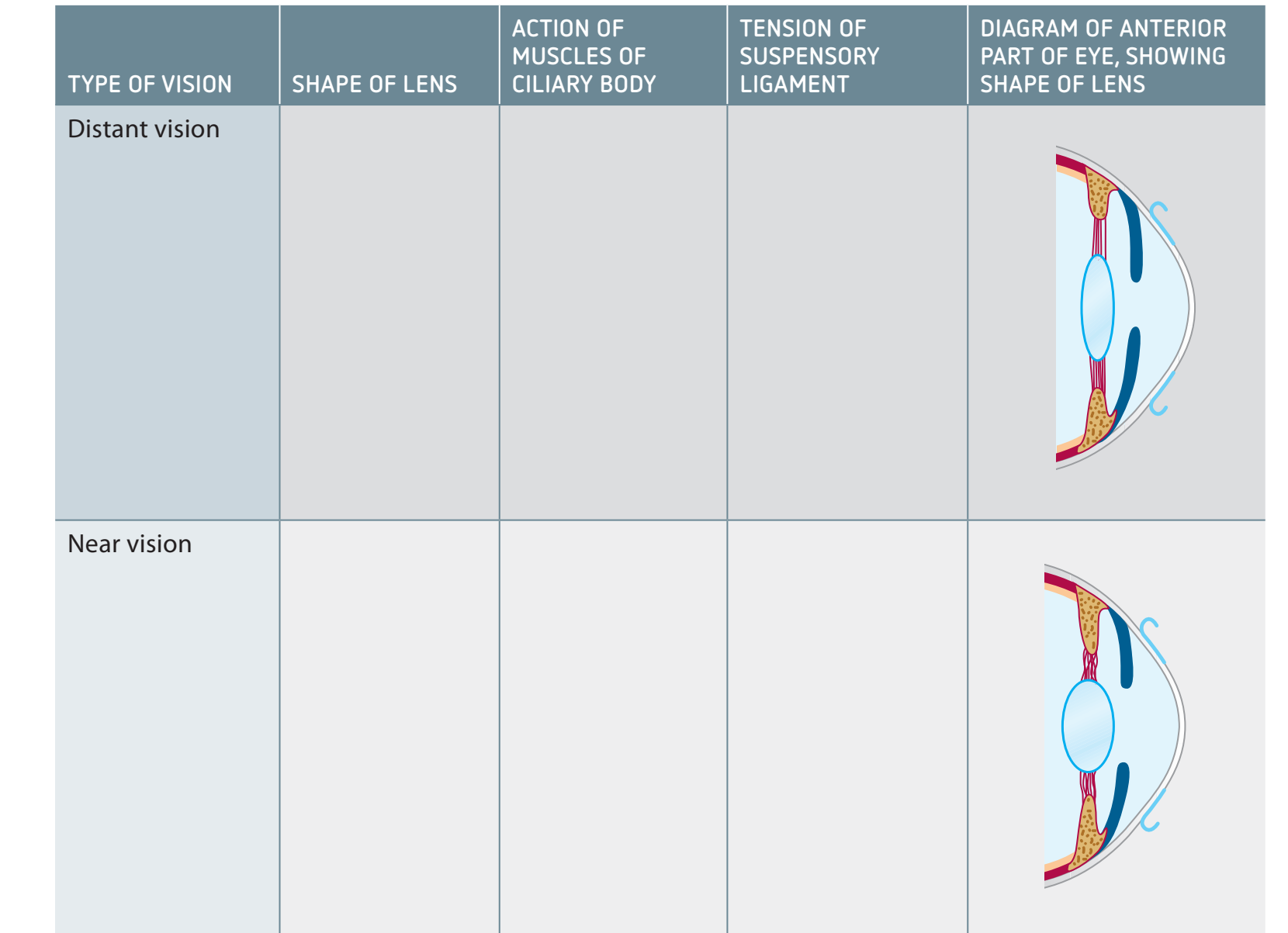 Diagram comparing LASIK and PRK procedures.