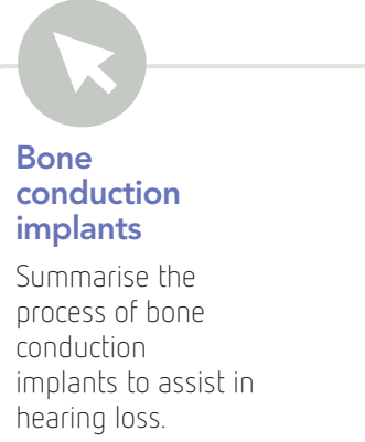 Illustrative diagram showing the placement and working mechanism of bone conduction implants.